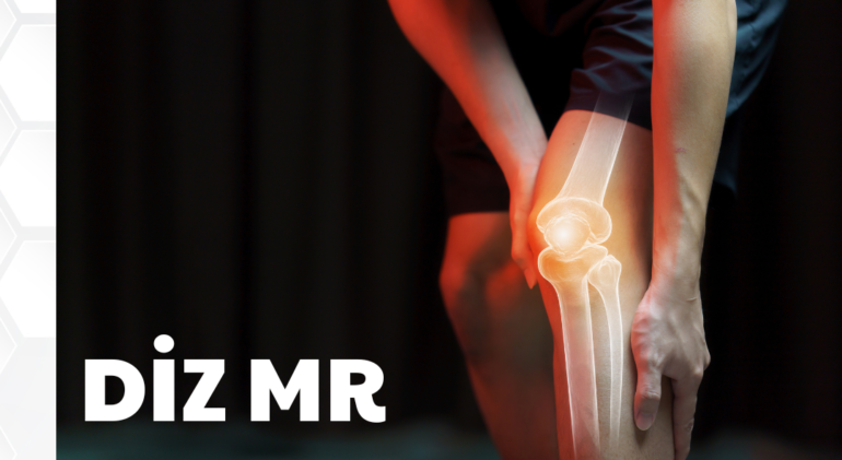 Ankara Diz MR
