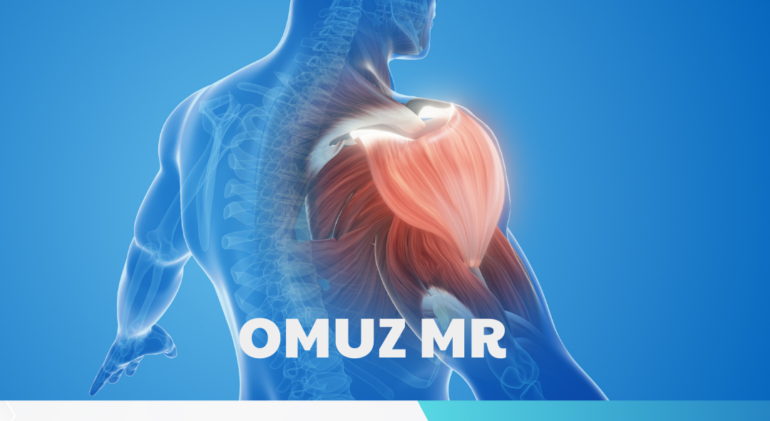 Omuz mr çeken ankaradaki merkezler