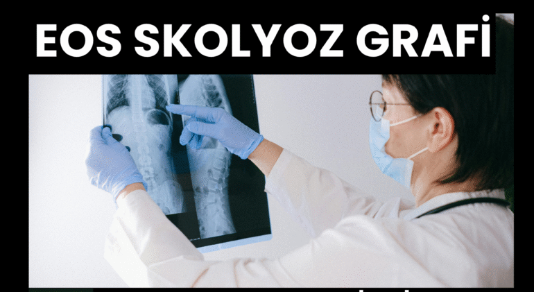 OS Skolyoz Grafisi, Tüm Vücut Grafisi, Bacak Uzunluk Grafisi ve 3D Modelleme