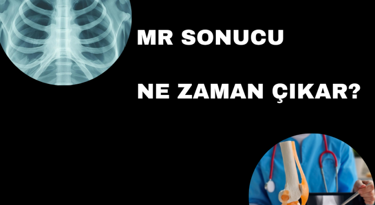 e-nabiz-sonucu-kac-gunde-cikar