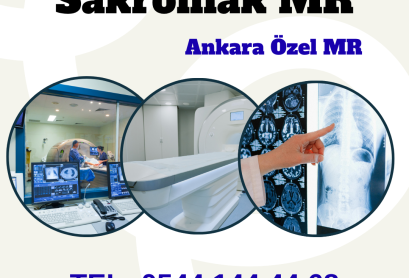 sakroiliyak emar ankara tesla emar Sakroiliak MR